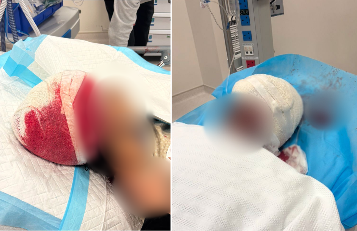 أسد يهجم على شاب قطري بأم صلال