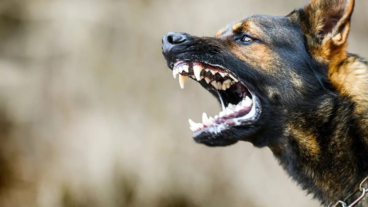 عضّة كلب مسعور 